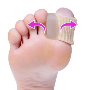 Hallux valgus orthosis